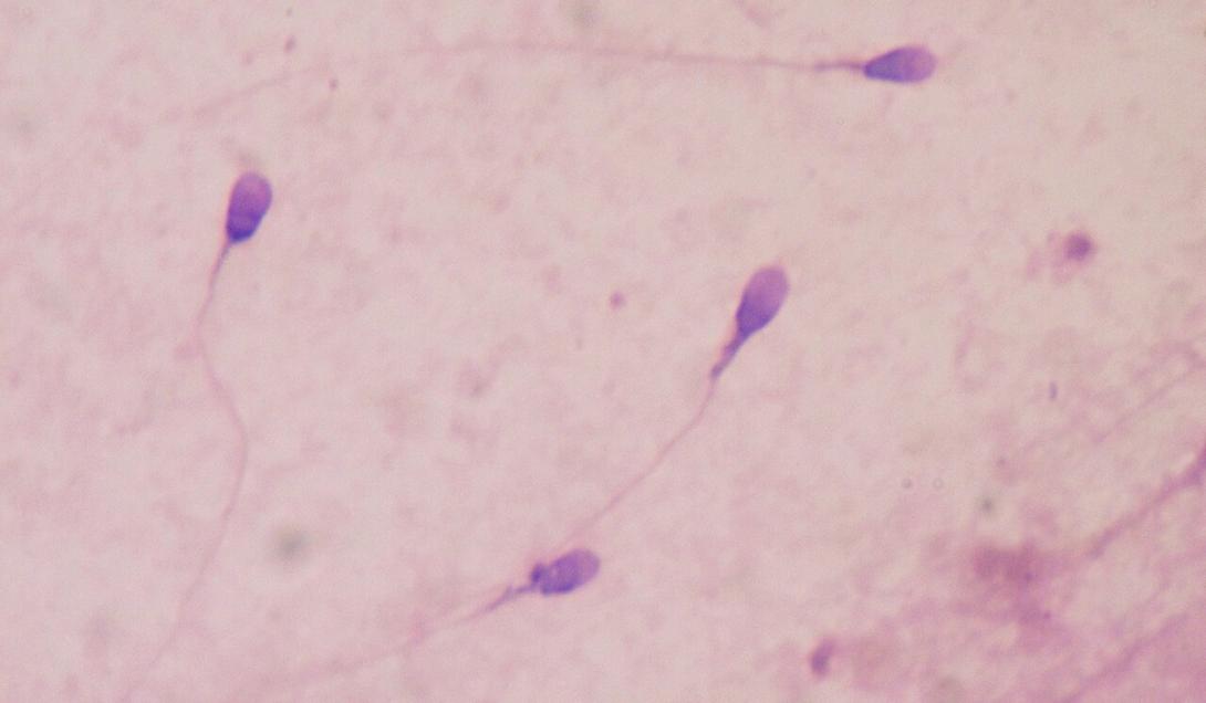 Cientistas se surpreendem ao detectar microplásticos em testículos humanos-0